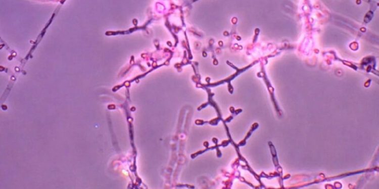 Рідкісна грибкова інфекція стрімко поширюється в світі: заходи безпеки для українців